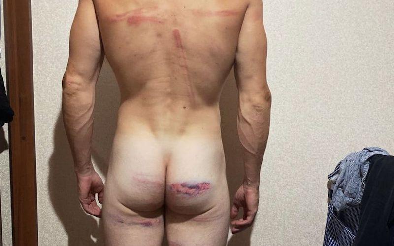 Alexei Kuzmich a été arrêté le 11 août. Emprisonné plusieurs jours, son corps garde les séquelles des tortures infligées par ses gardiens. © Alexei Kuzmich